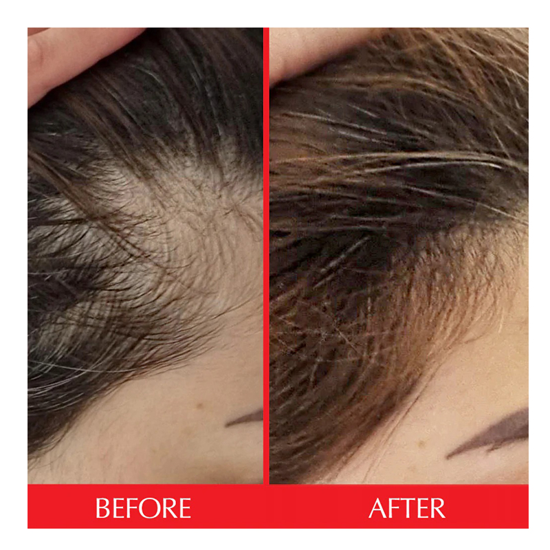 Hairtamin Gorgeous Growth Scalp Serum 60 ml Best Price in Dubai